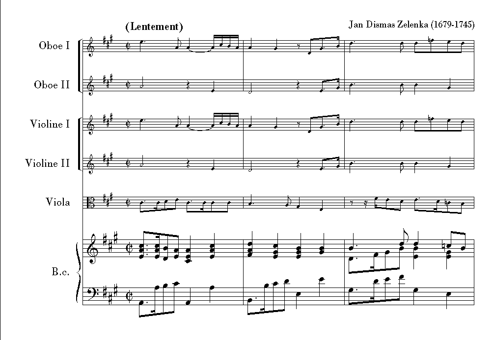 J.D. Zelenka: Hipocondrie fr<br>2 Oboen, Fagott, Streicher+BC - 7Stimmen